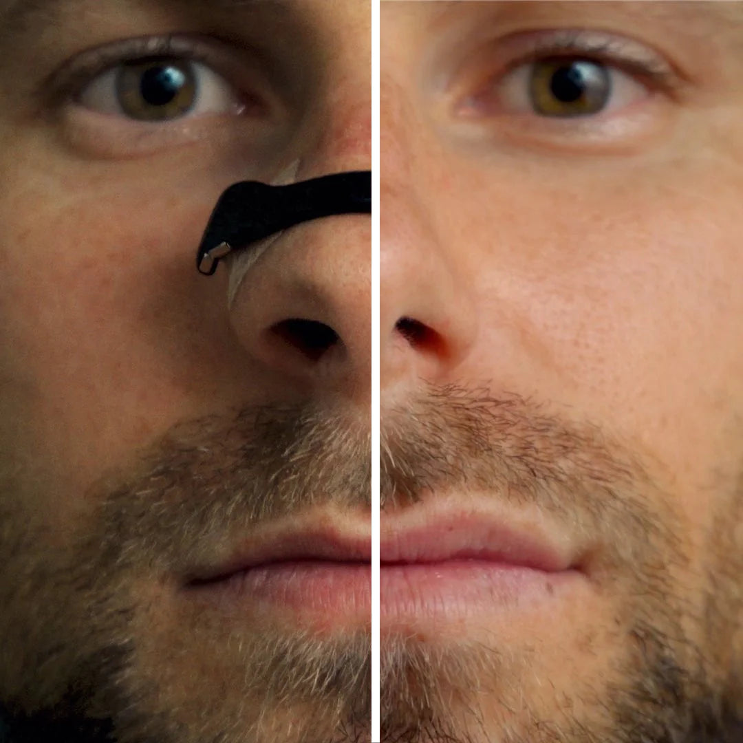 Oryon Magnetic Nasal Dilator