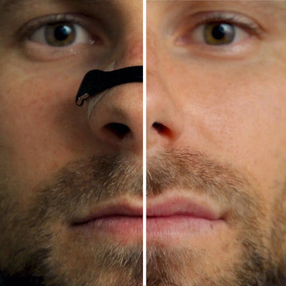 Oryon Magnetic Nasal Dilator